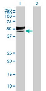 GCNT2 Polyclonal Antibody, MaxPab™