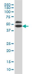 GDI1 Antibody in Western Blot (WB)