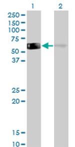 GDI1 Monoclonal Antibody (2C2)