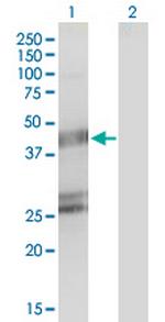 GFAP Monoclonal Antibody (2E9)