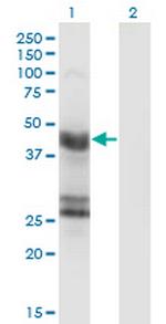 GFAP Monoclonal Antibody (8H3)
