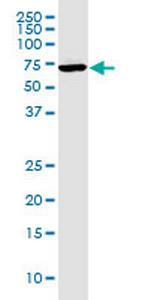 GGT1 Antibody in Western Blot (WB)