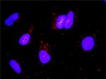 GHR Antibody in Proximity Ligation Assay (PLA) (PLA)