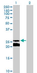 GJB5 Polyclonal Antibody, MaxPab™