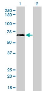 GCLC Antibody in Western Blot (WB)