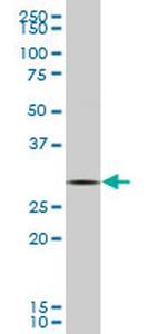 GCLM Monoclonal Antibody (2C6)