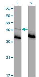 GLRA1 Monoclonal Antibody (2E6)