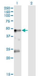 GLRA1 Monoclonal Antibody (2E7)