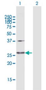 GLUD2 Polyclonal Antibody, MaxPab™