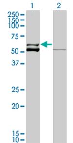 GLUD2 Antibody in Western Blot (WB)