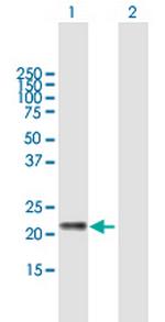 GM2A Polyclonal Antibody, MaxPab™