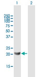 GM2A Antibody in Western Blot (WB)