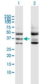 GNA11 Polyclonal Antibody, MaxPab™