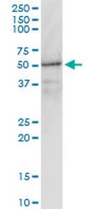 GNAI1 Antibody in Western Blot (WB)