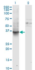 GNAI1 Antibody in Western Blot (WB)