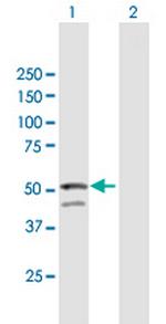 GNAL Antibody in Western Blot (WB)