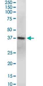 GNAQ Monoclonal Antibody (3B9)