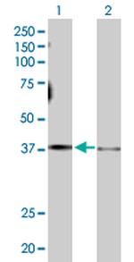GNAS Polyclonal Antibody, MaxPab™