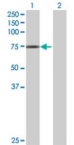 GNL1 Antibody in Western Blot (WB)