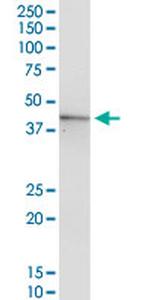 GOT1 Antibody in Western Blot (WB)