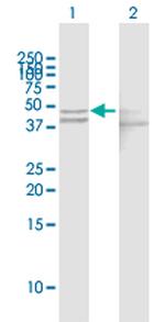 GOT1 Antibody in Western Blot (WB)