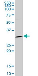 SFN Antibody in Western Blot (WB)