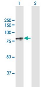 GP1BA Antibody in Western Blot (WB)