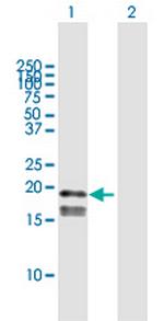 GP9 Polyclonal Antibody, MaxPab™