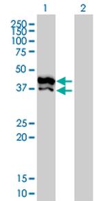 GPD2 Monoclonal Antibody (2C11-1F4)
