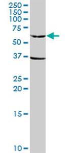 GPI Antibody in Western Blot (WB)