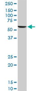 GPI Antibody in Western Blot (WB)