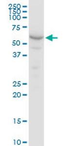 GPI Antibody in Western Blot (WB)
