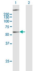 GPR34 Antibody in Western Blot (WB)