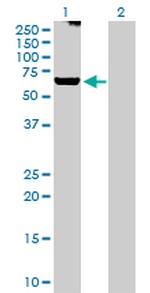 GRK6 Antibody in Western Blot (WB)