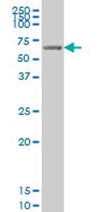 GRK6 Antibody in Western Blot (WB)