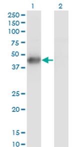 MKNK2 Monoclonal Antibody (2A10)