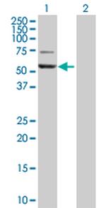 GPT Polyclonal Antibody, MaxPab™
