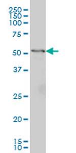 GPT Antibody in Western Blot (WB)