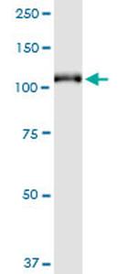 GRM6 Monoclonal Antibody (1A11)