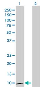 CXCL1 Antibody in Western Blot (WB)