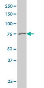 GSN Antibody in Western Blot (WB)