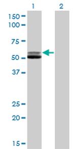 GSR Antibody in Western Blot (WB)