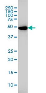 GSR Antibody in Western Blot (WB)