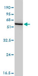 GSS Antibody in Western Blot (WB)