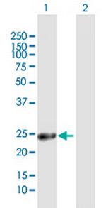 GSTA1 Polyclonal Antibody, MaxPab™