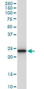 GSTA1 Antibody in Western Blot (WB)