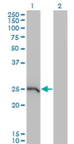 GSTA1 Monoclonal Antibody (1F9)
