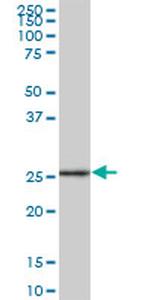 GSTA2 Antibody in Western Blot (WB)