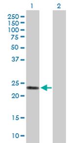 GSTA2 Polyclonal Antibody, MaxPab™