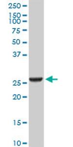 GSTA2 Antibody in Western Blot (WB)